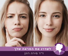 טיפול בוטוקס בין הגבות